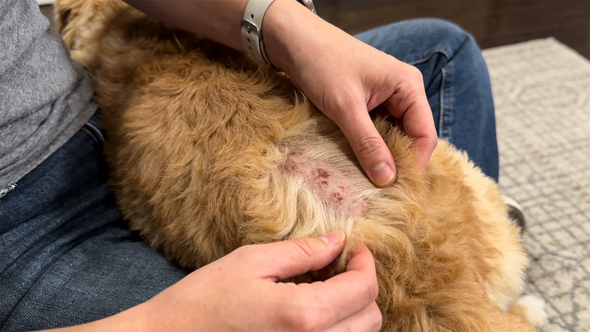 Seasonal hair loss vs. pathological hair loss: A simple trick to distinguish them